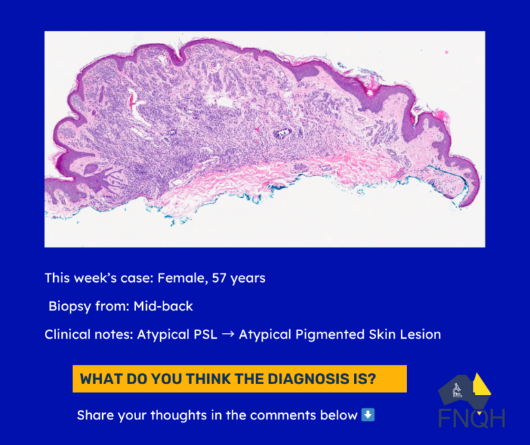 Microscopic Monday F57