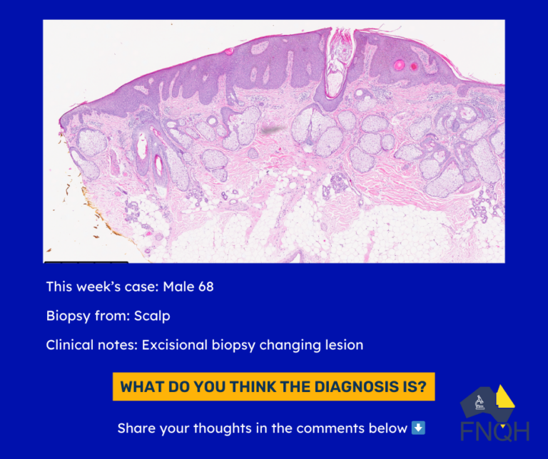 Microscopic Monday (1)